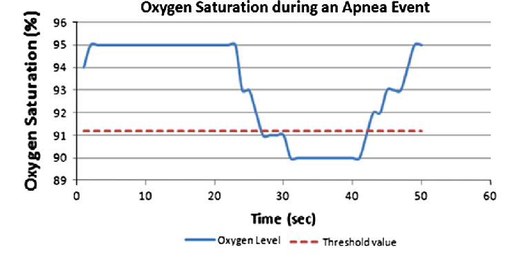 sleep apnea